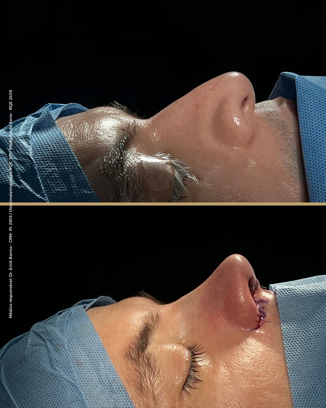 Antes e depois — caso clínico 1