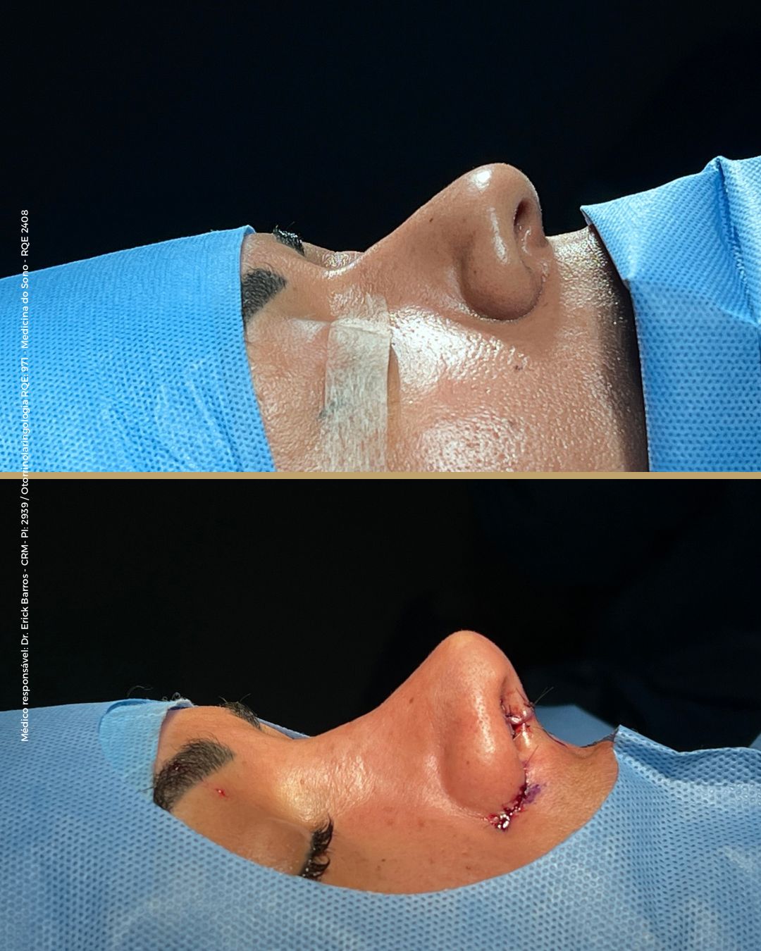 Antes e depois — caso clínico 10