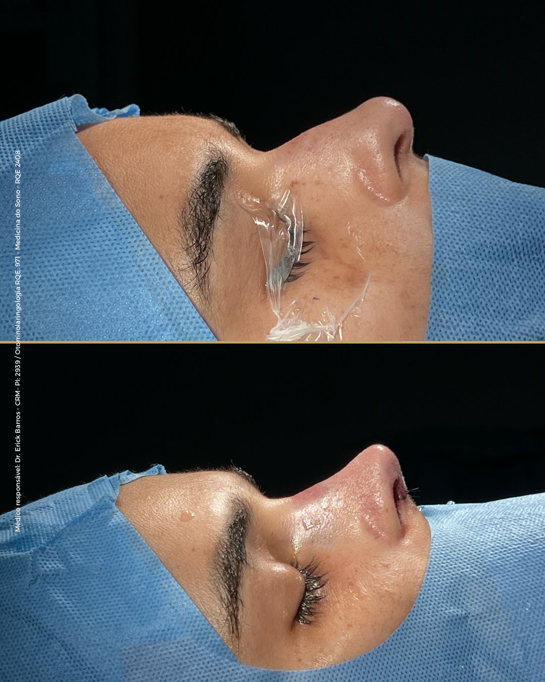 Antes e depois — caso clínico 12