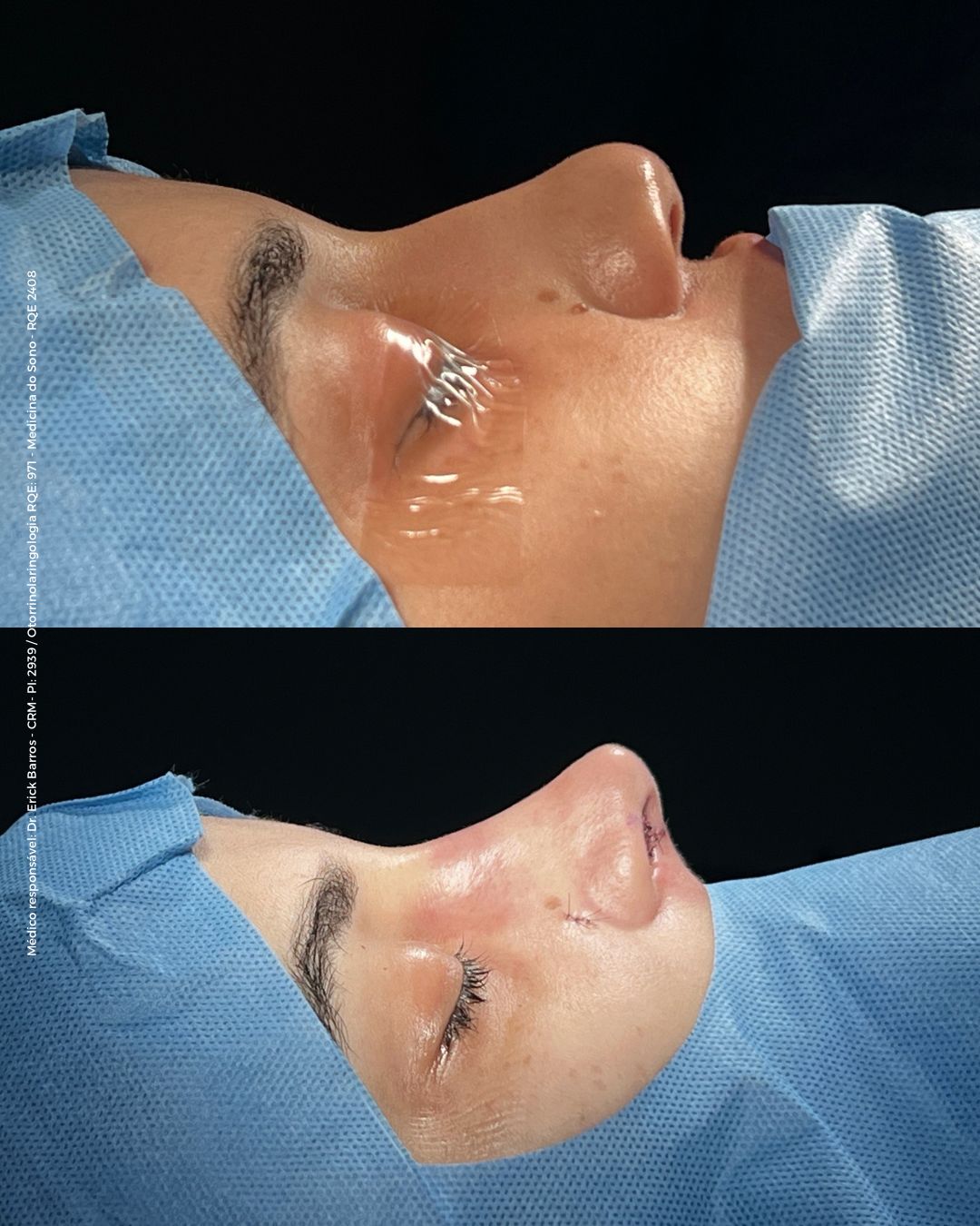 Antes e depois — caso clínico 13