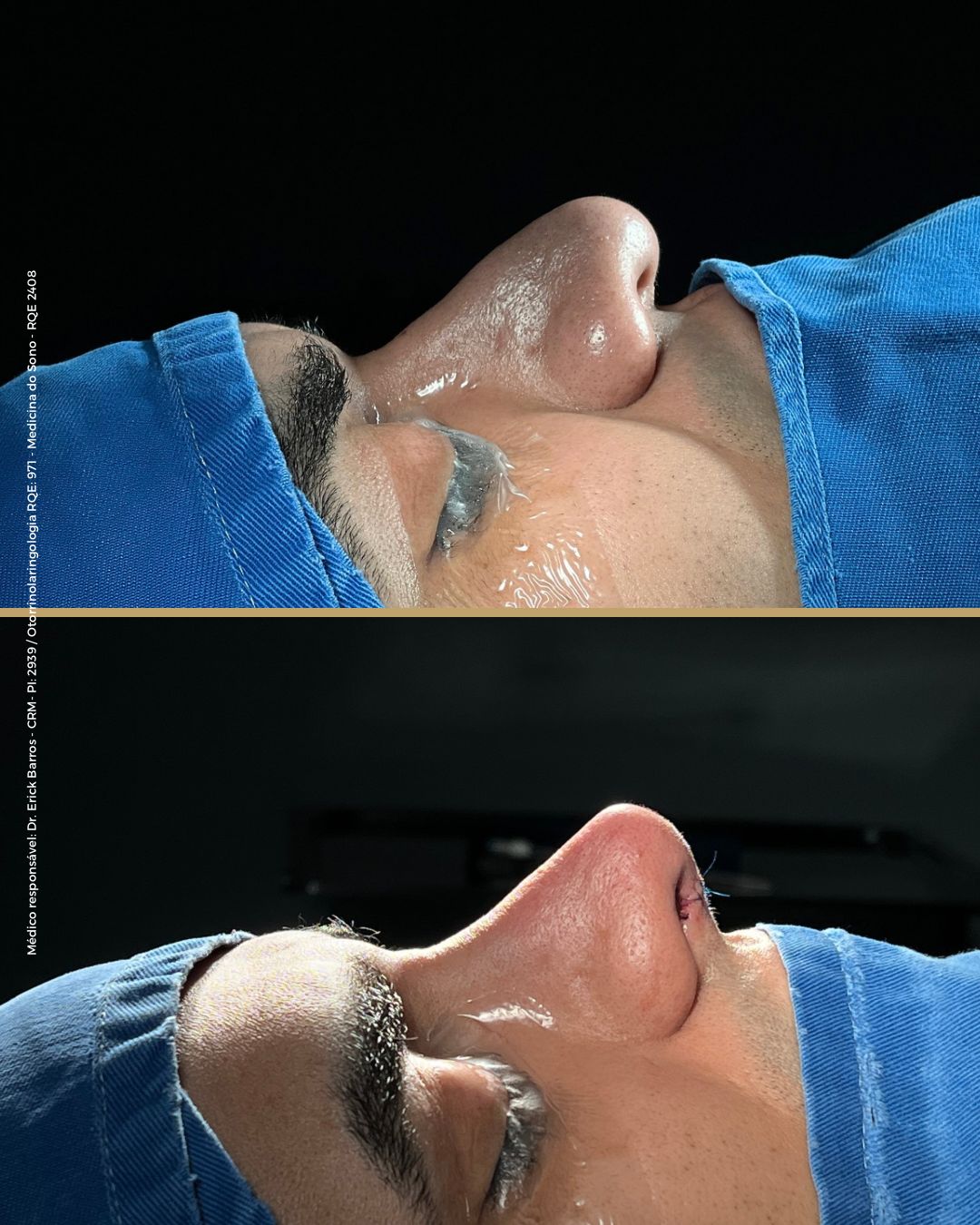 Antes e depois — caso clínico 2