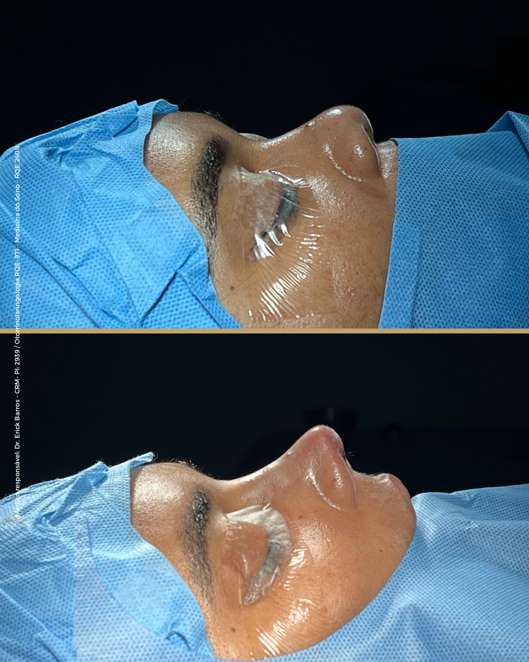 Antes e depois — caso clínico 3