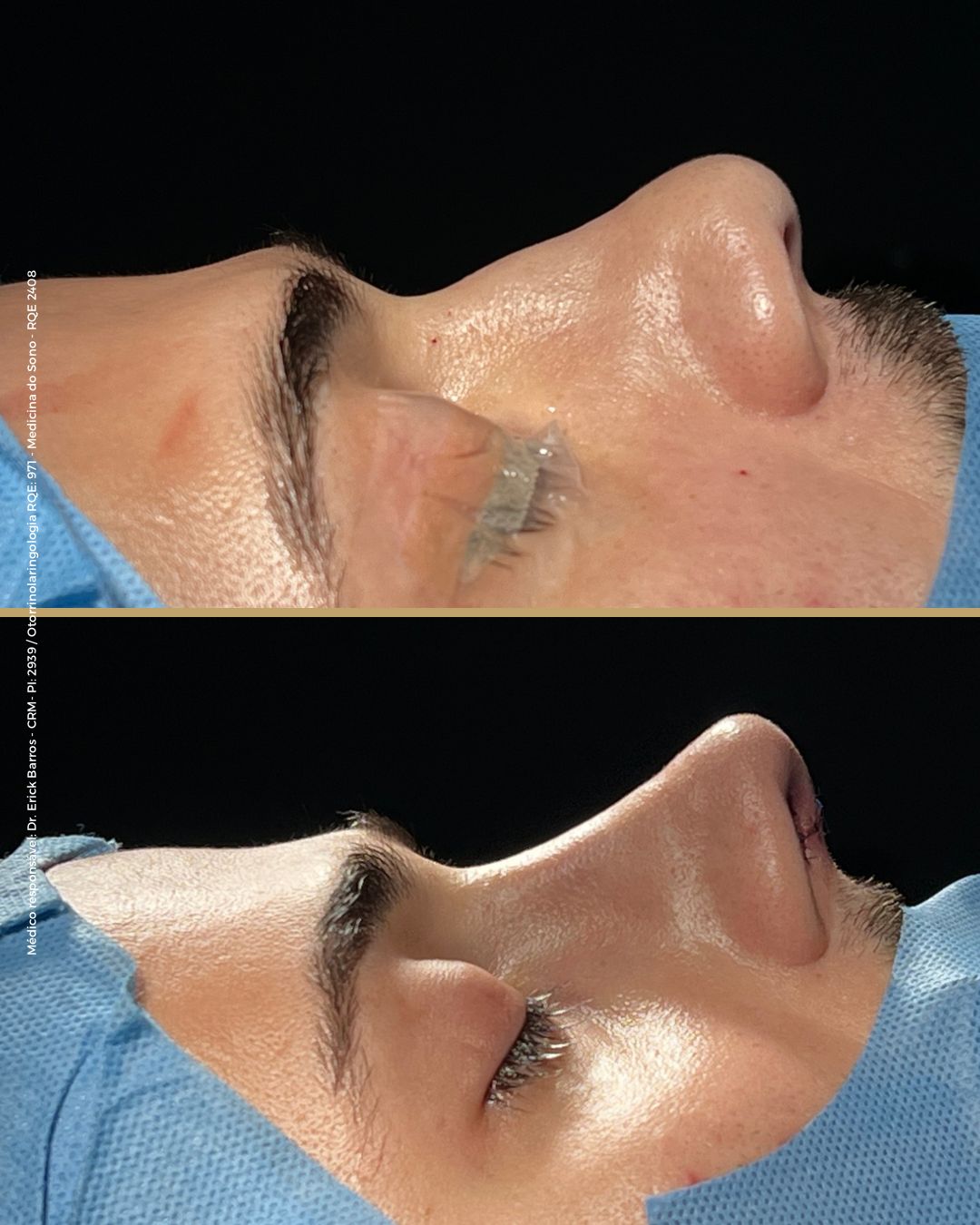 Antes e depois — caso clínico 4