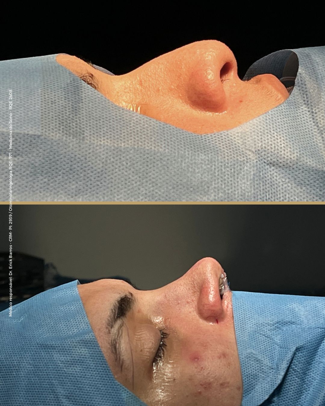Antes e depois — caso clínico 5