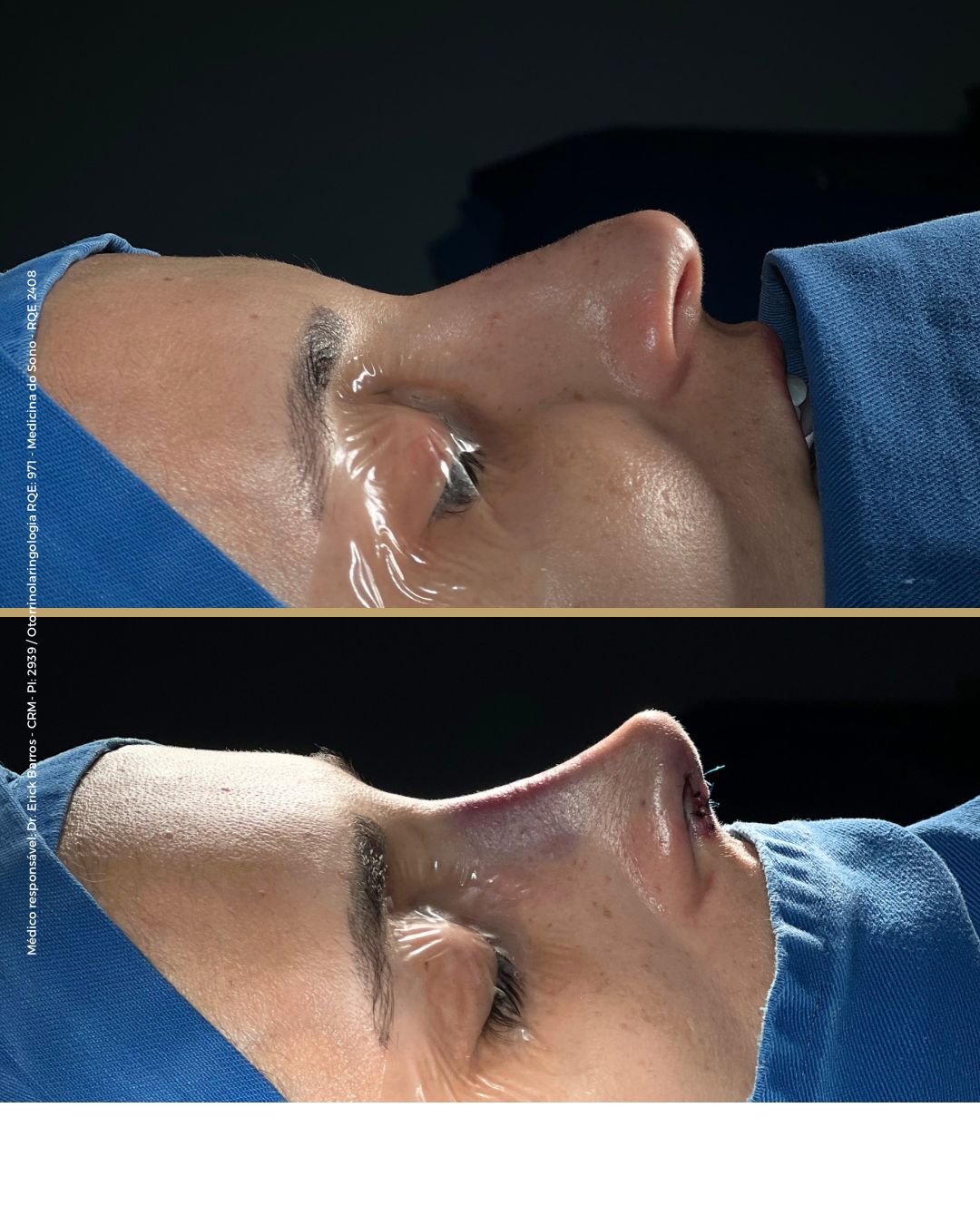 Antes e depois — caso clínico 6