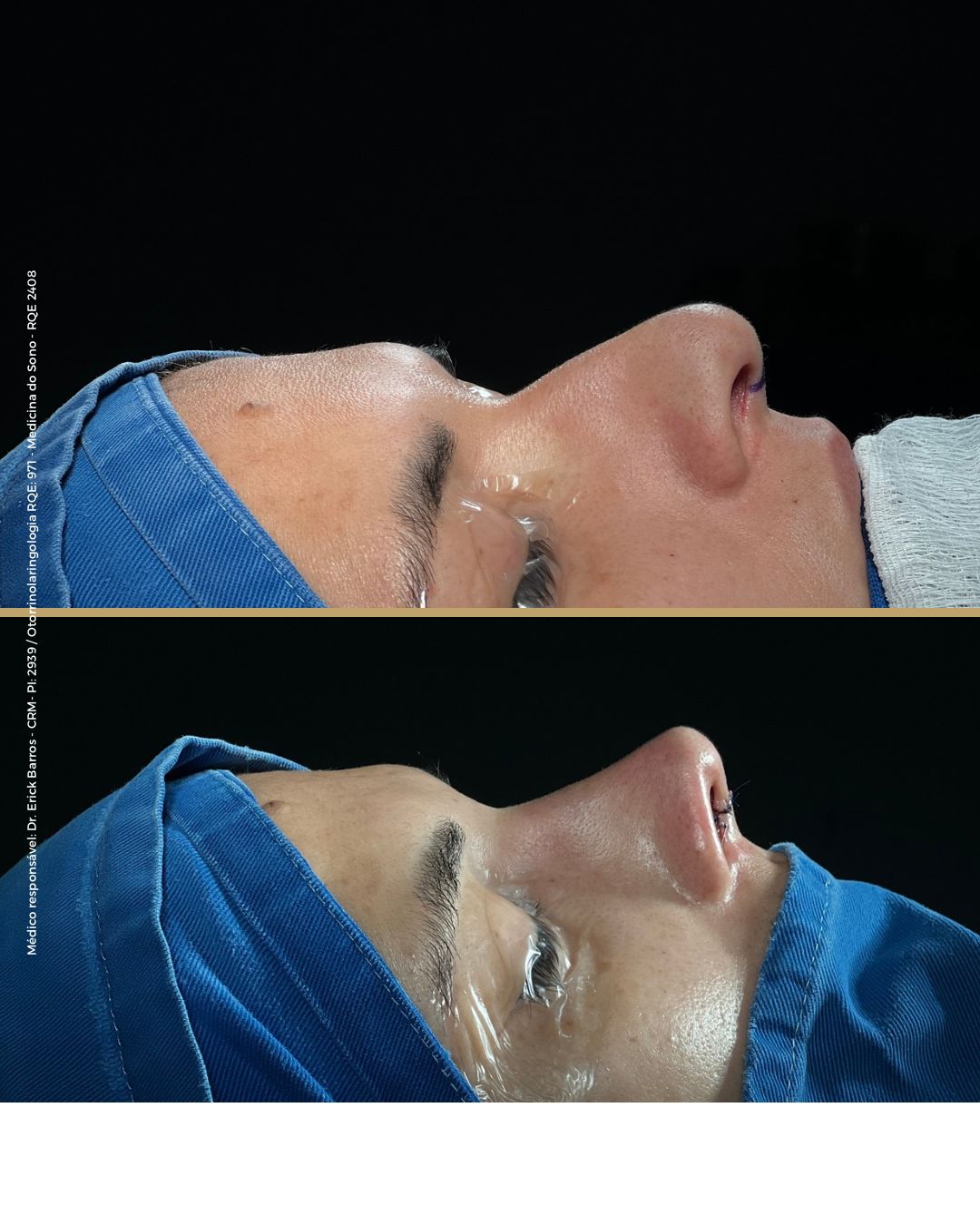 Antes e depois — caso clínico 7