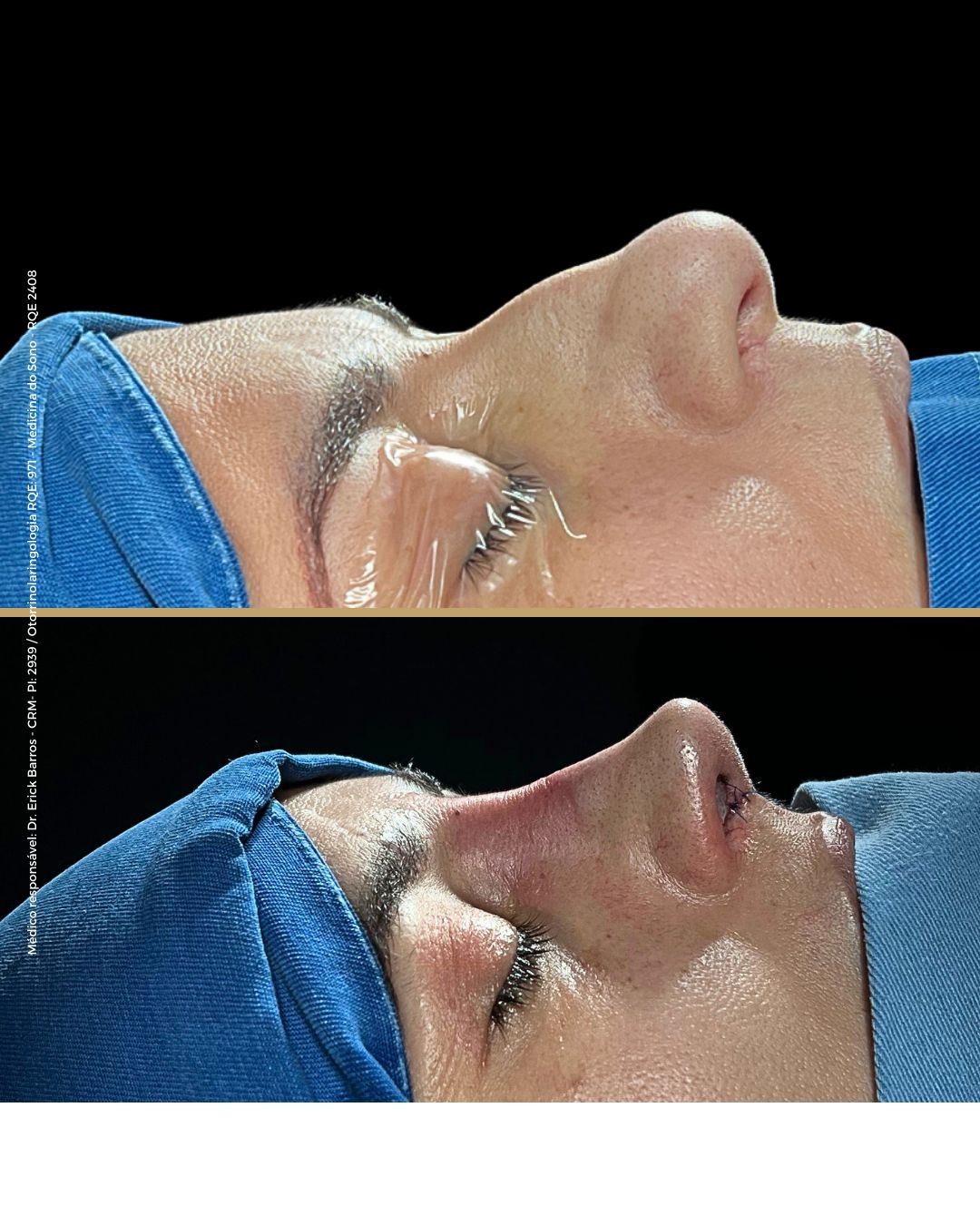 Antes e depois — caso clínico 8