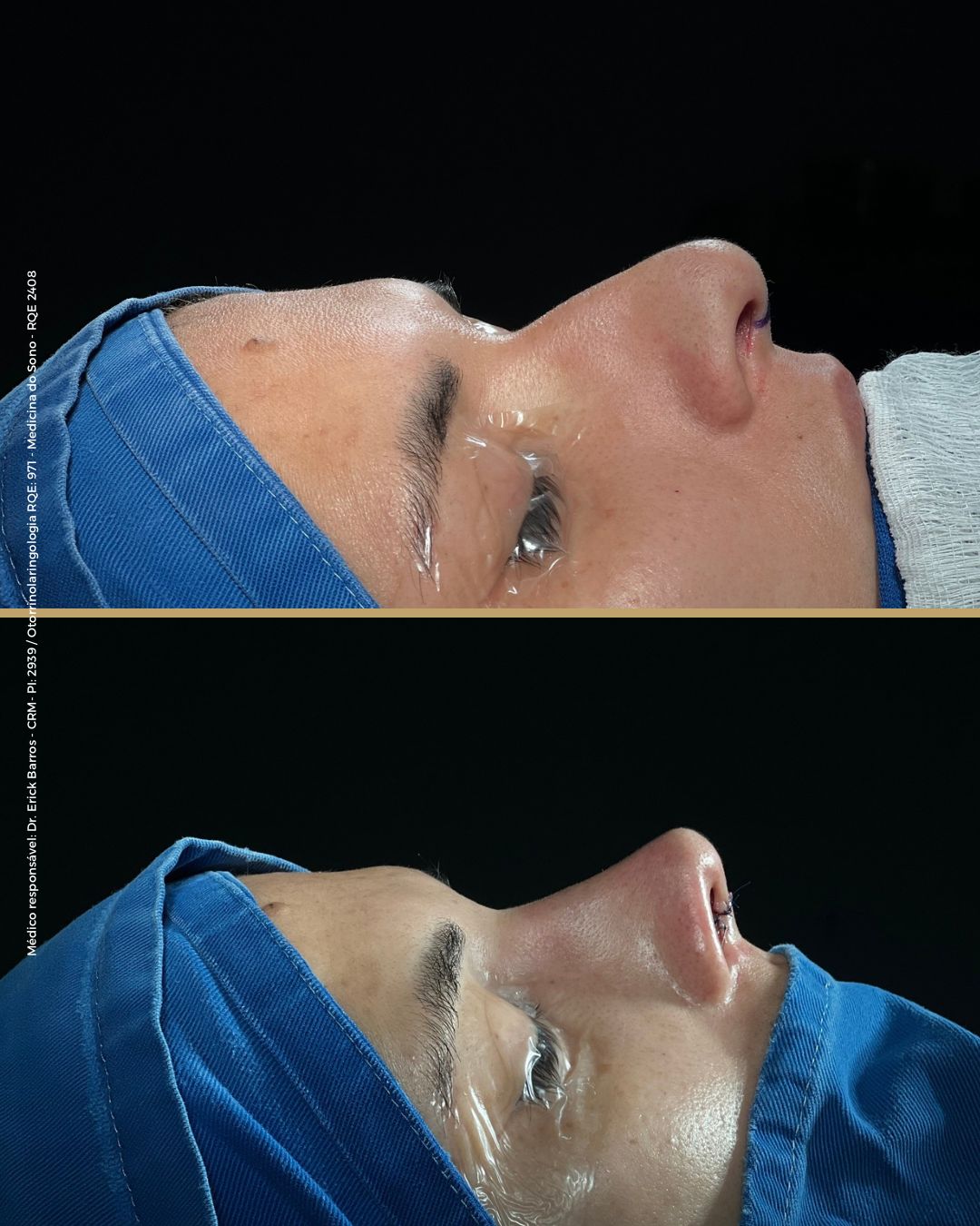 Antes e depois — caso clínico 9